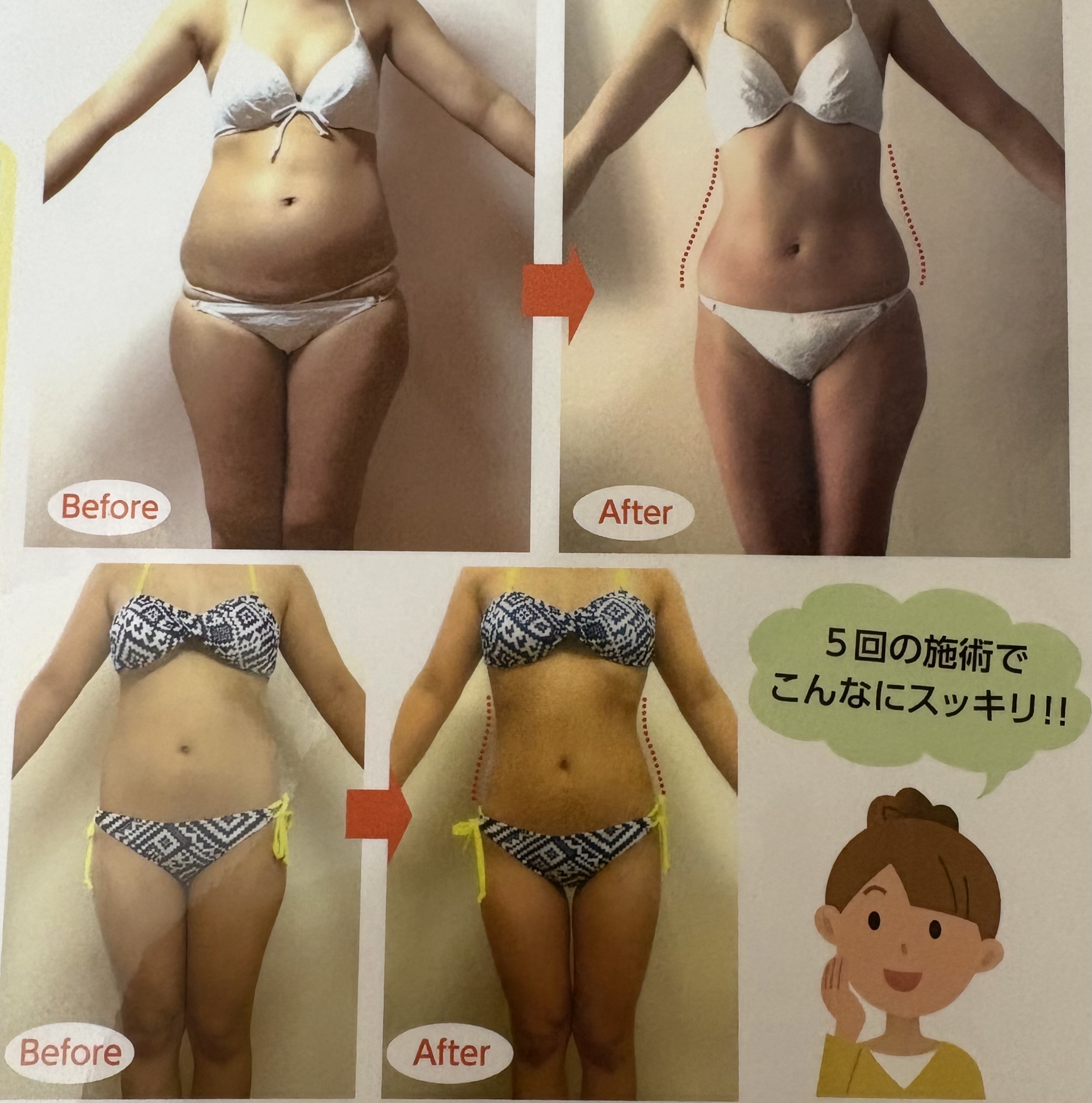 Body