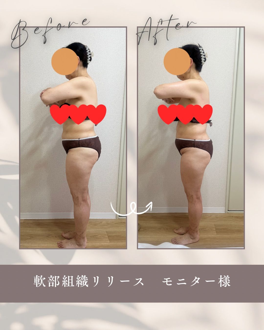 軟部組織リリース（横姿勢・体型ラインケア）