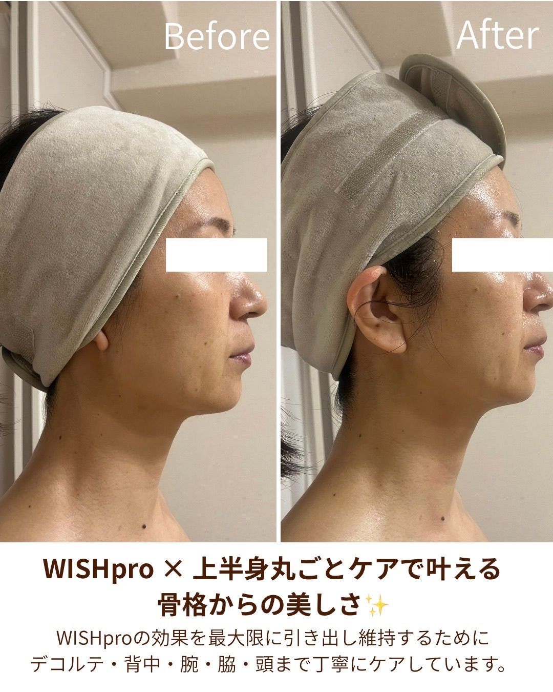 軟部組織リリース（全身バランス調整）