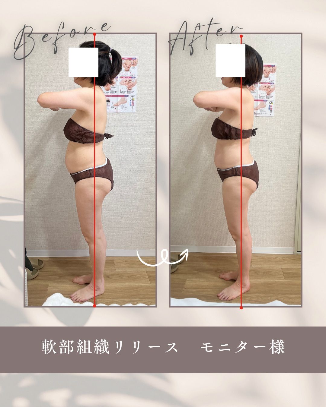 軟部組織リリース（全身バランス調整）