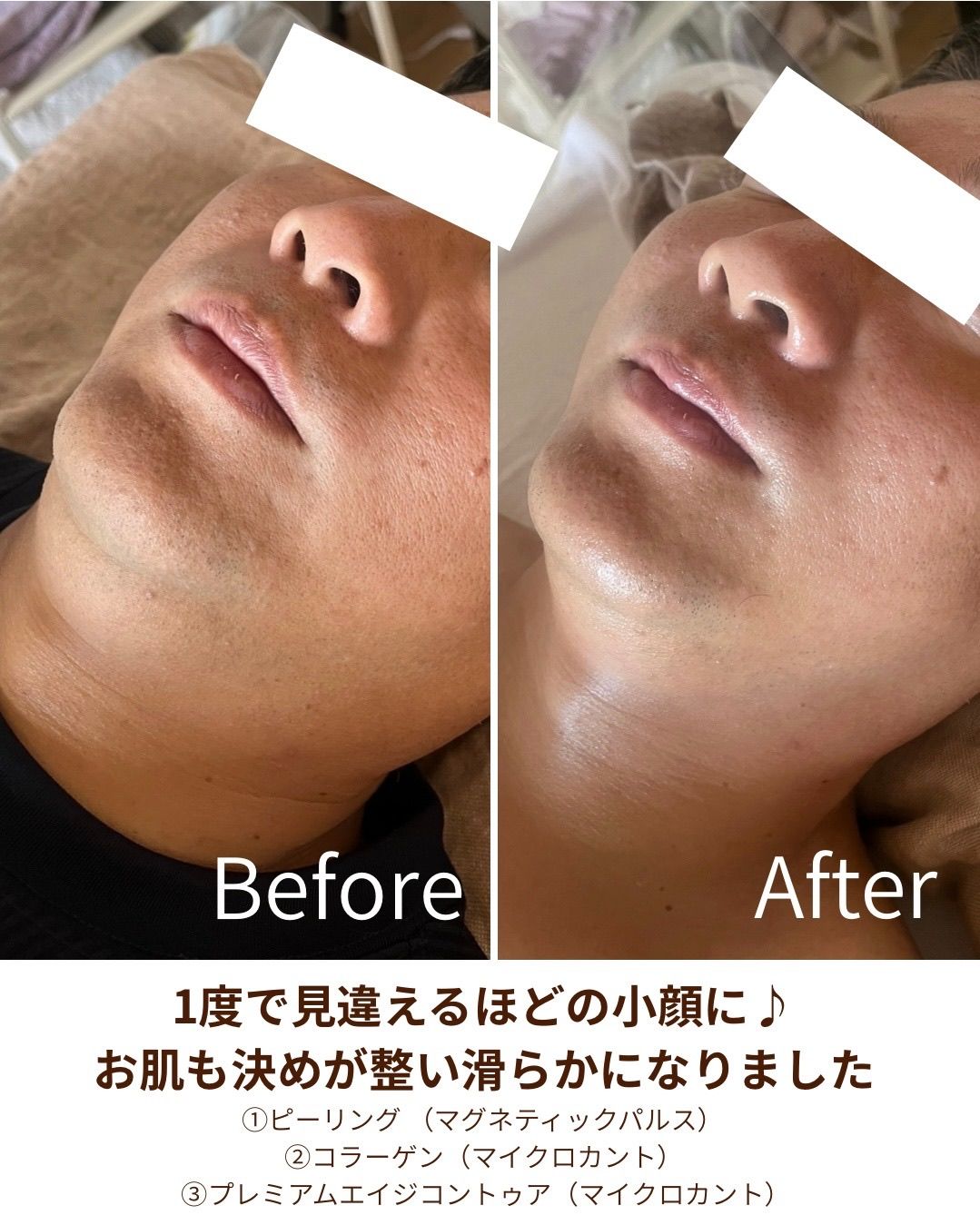 軟部組織リリース（全身バランス調整）