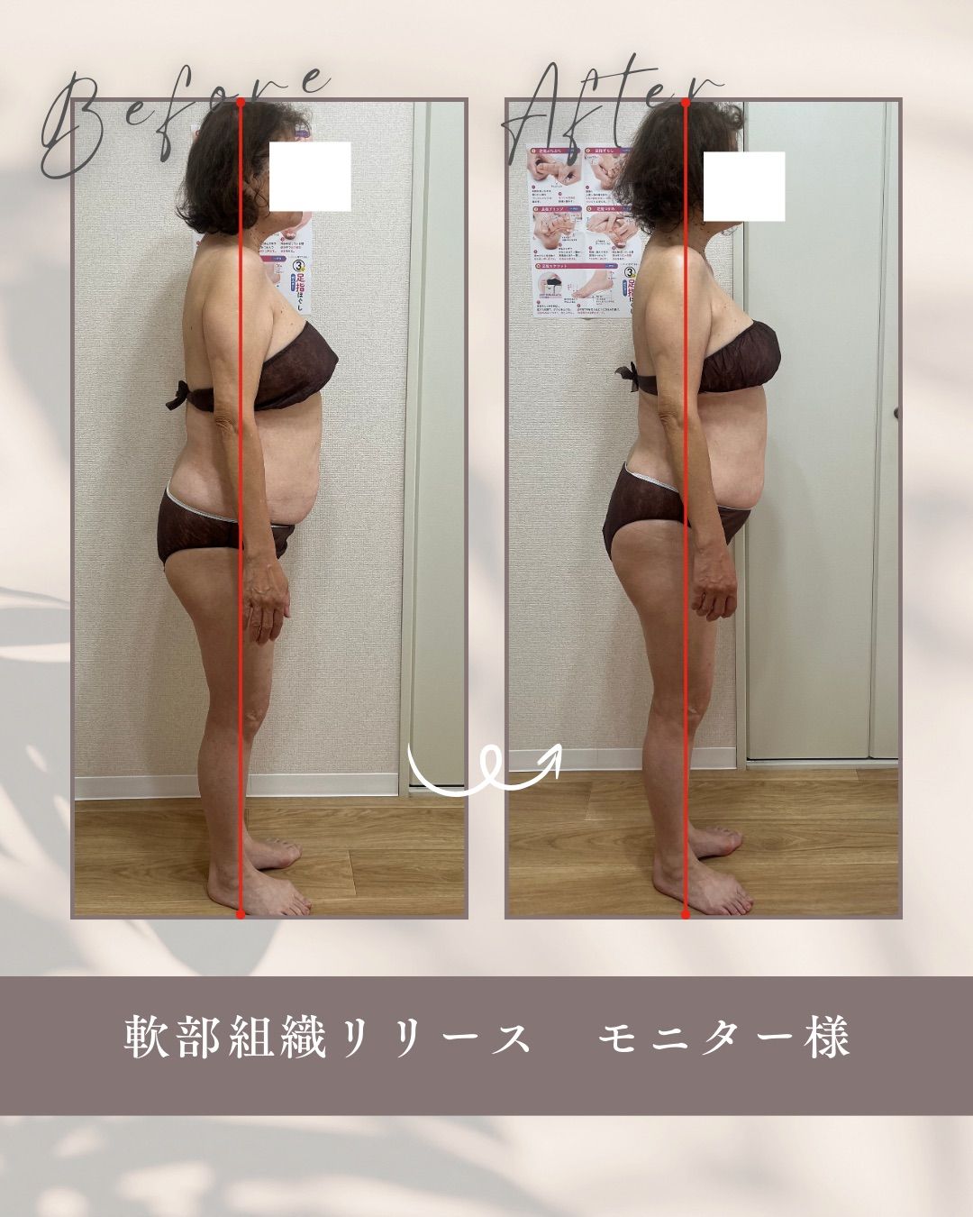 ボディ施術イメージ1
